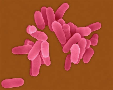 Mycobacterium Tuberculosis Photograph By Dennis Kunkel Microscopy