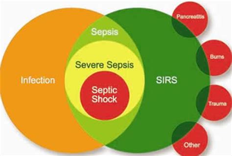 Septicemia is usually associated with sepsis. SEPSIS | Medicina Interna al día