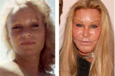 the 17th most famous celebrity plastic surgery 17 before and after photos plasticsurgery