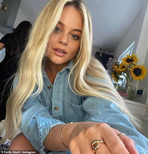 Emily Atack Shares Her Experience Of Being Sexually Harassed By Sexual