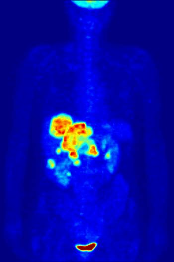 Medical Imaging Techniques: Types & Uses | Study.com