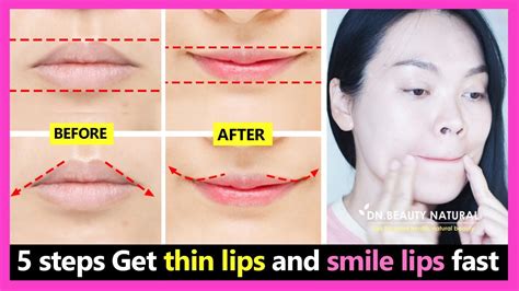 Make Lips Smaller Without Surgery