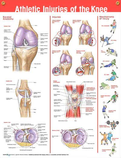 Knee Pain Chart