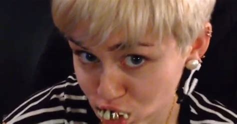 Miley Cyrus Has Got Some Serious Dental Problems Going On In This Video