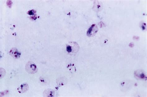 Kostenlose Bild dünn Film Mikrobild zeigt reif trophozoite Parasiten Plasmodium ovale