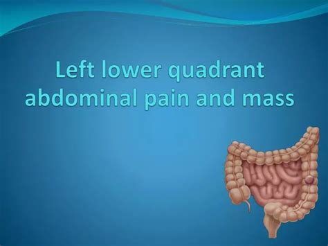 Ppt Left Lower Quadrant Abdominal Pain And Mass Powerpoint