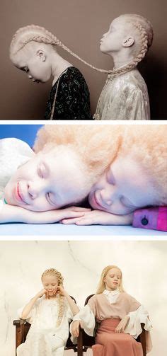 Albino Beauty Ideas In Albino Albinism Beauty