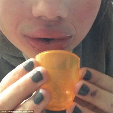 Kylie Jenner Challenge Sees Teens Suck Shot Glasses To Blow Up Their