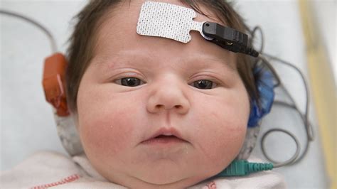 Newborn Hearing Screening Babycenter