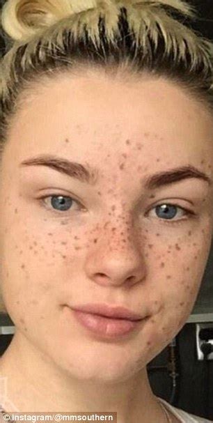 Beauty Trend Sees People Tattooing Freckles On Their Faces Daily Mail