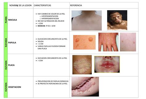 Lesiones De La Piel Nicole Gaona Udocz