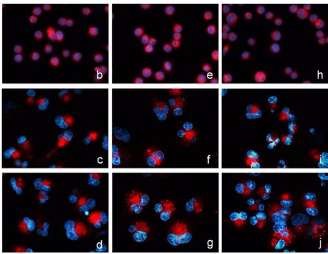 Cell Cell Image Adhesion Assay Creative Bioarray Cellassay
