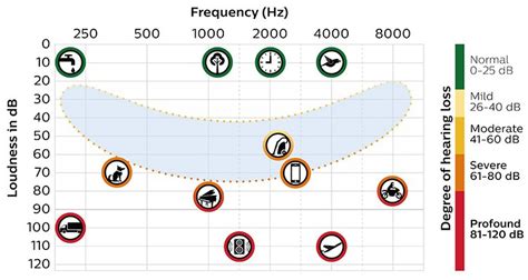 Understand Hearing Loss And How To Prevent It Philips