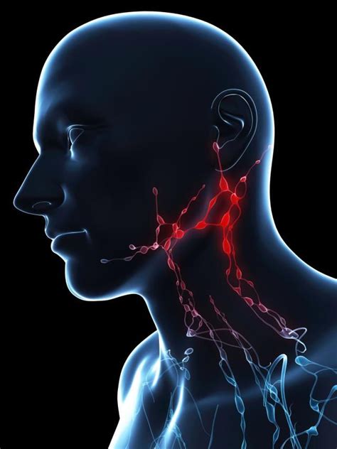 Do You Know What Causes Swollen Lymph Glands