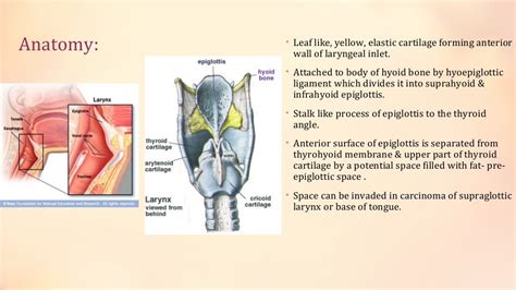 Acute Epiglottitis