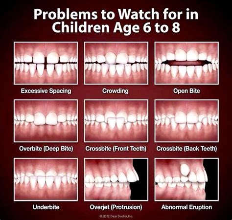 Age Do Children Get Braces Teeth