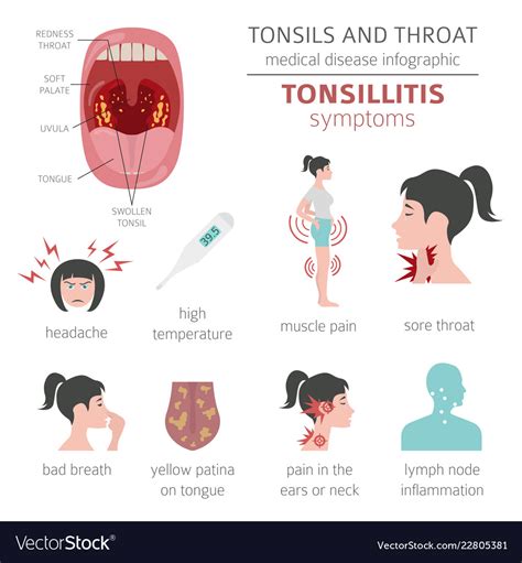 Tonsillitis Types