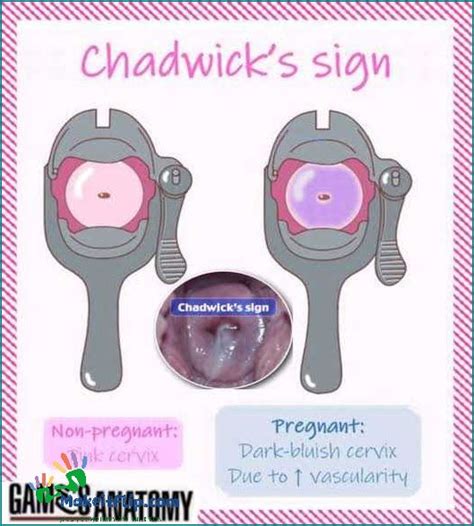 Chadwick Sign In Pregnancy What You Need To Know Updated May 2024
