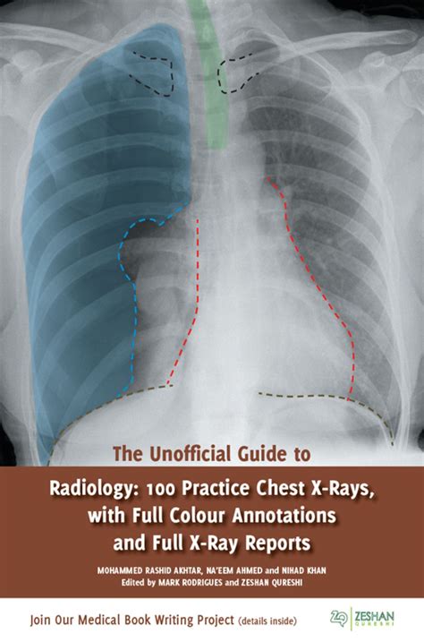 The Unofficial Guide To Radiology Ebook Radiology Made Easy Books