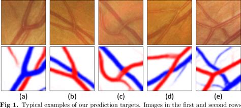 Figure 1 From Automated Grading System Of Retinal Arterio Venous