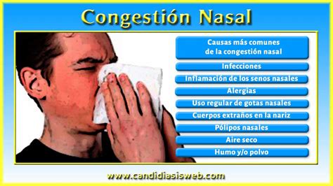 Otros Síntomas Congestión Nasal