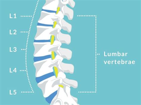 bulging disc l4 l5 guide treatment causes and symptoms 2022