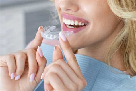 Everything You Need To Know About Invisalign I7 Dulwich Orthodontics