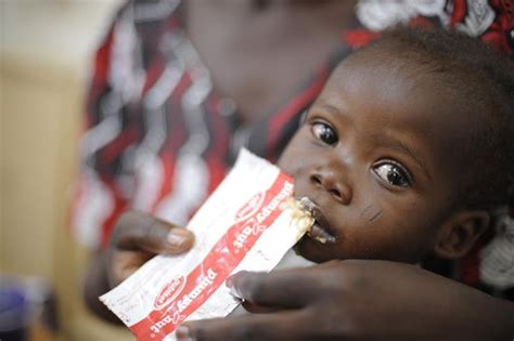 Allarme Malnutrizione Ogni Anno Muoiono Oltre 3 Milioni Di Bambini