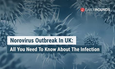Norovirus Outbreak In Uk All You Need To Know About The Infection