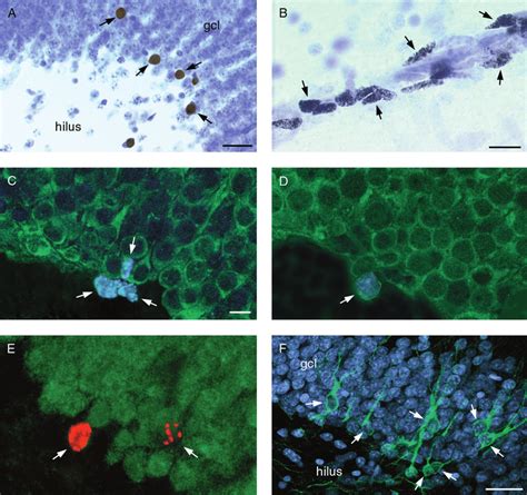 Photomicrographs A And B And Confocal Laser Scanning Microscopic