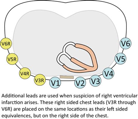 The Ecg Leads Electrodes Limb Leads Chest Precordial Leads 12