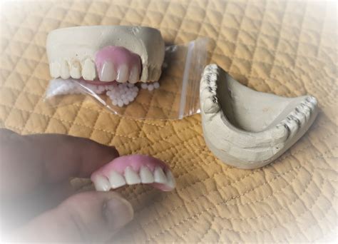 Missing Tooth Acrylic Teeth Veneer Kit Shade A2 False Etsy