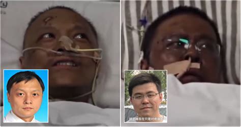 Chinese Doctors Wake Up With Dark Skin After Recovering