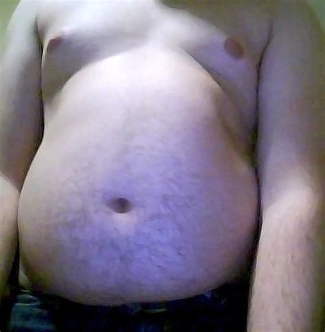 Are Males With Klinefelter Syndrome KS More Prone To Weight Gain