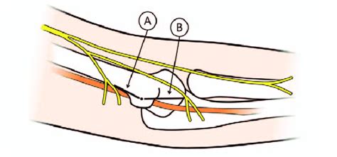 Medial Antebrachial Cutaneous Nerve Elbow