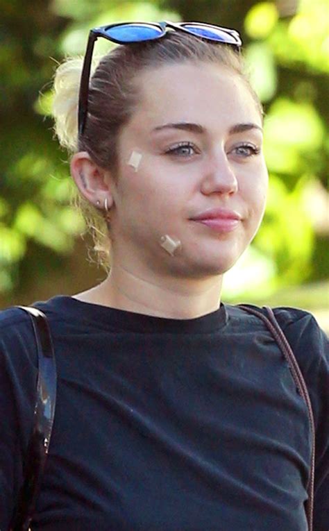 Miley Cyrus Leaves The Doctors Office With Bandages On Her Face E