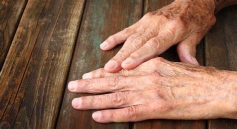 Common Skin Conditions In Aging Blessed Home