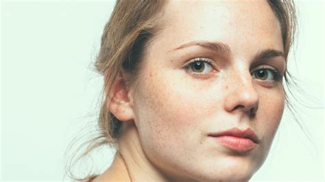 Summer Sun And Freckles Unraveling The Mystery Of Melanin And Uv Rays