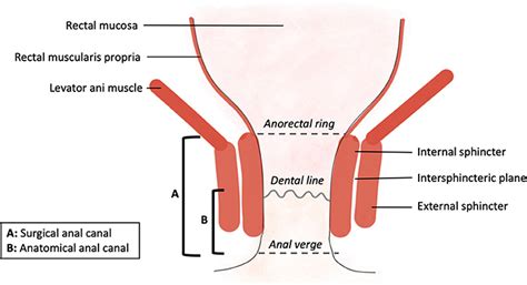 External Rectal Cancer Pictures