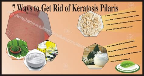 7 Ways To Get Rid Of Keratosis Pilaris Skin Disorder Herbs Solutions