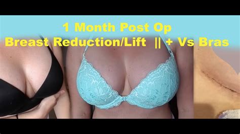 1 Month Post Op Vs Bras {mastopexy Breast Lift} Boob Vlog Youtube