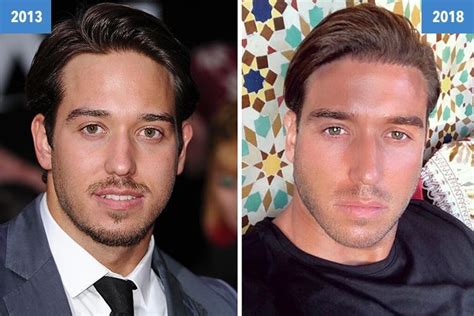 James Lock Looks Dramatically Different Five Years After Joining Towie