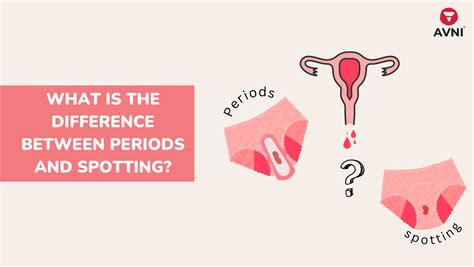 what is the difference between periods and spotting