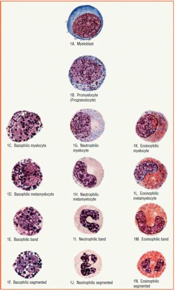 Pdf Classification Of White Blood Cell Abnormalities For Early