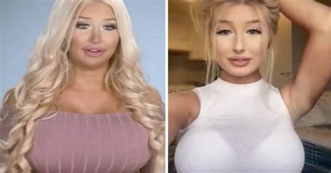 Womans Dream Is To Become A Real Life Sex Doll ‘plastic Surgery Is