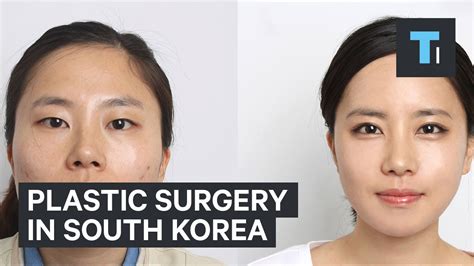 Plastic Surgery In South Korea Oasis Medical Aesthetics