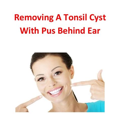 Removing A Tonsil Cyst With Pus Behind Ear