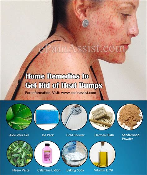 Pin On Skin Diseases