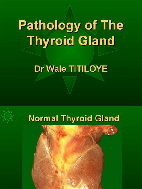 Pathology Of Thyroid Thyroid Hyperthyroidism