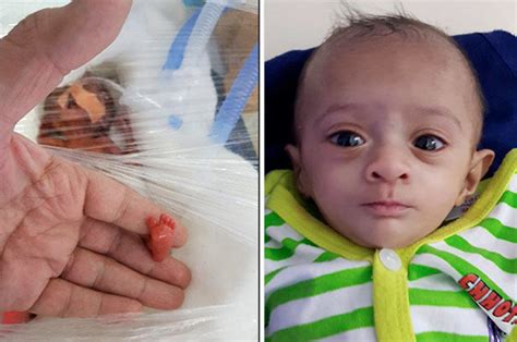 Worlds Smallest Baby Asia Manushi Survives Despite Weighing Same As